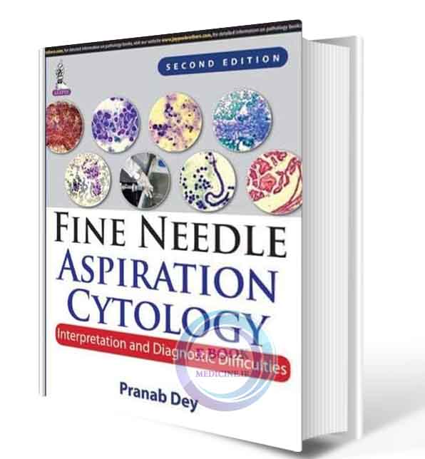 دانلود کتاب Fine Needle Aspiration Cytology: Interpretation and Diagnostic Difficulties 2nd  2017 (ORIGINAL PDF)